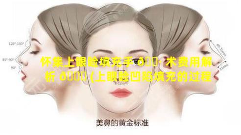 怀集上眼睑填充手 🌷 术费用解析 🍀 (上眼睑凹陷填充的过程是怎样的)